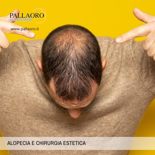 alopecia