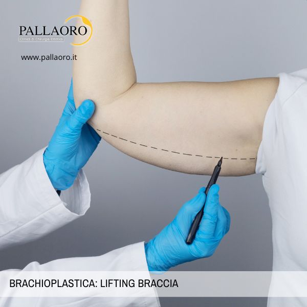 brachioplastica lifting braccia