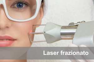 Peeling laser frazionato