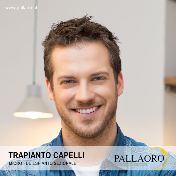 trapianto capelli Mantova